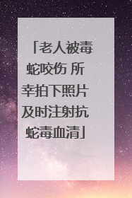 老人被毒蛇咬伤 所幸拍下照片及时注射抗蛇毒血清